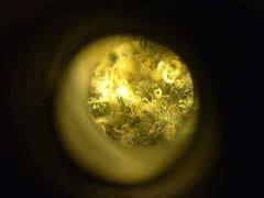 Trichomes BB