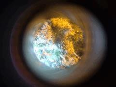 Trichomes PPP