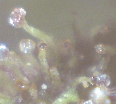 Hybrides PCK