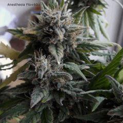 01anesthesia (3)