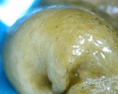 macro extraction DME mal purgé 7