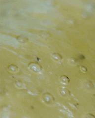 macro extraction DME mal purgé 6