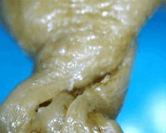 macro extraction DME mal purgé 4
