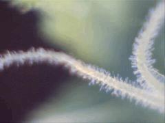 Essai microscope à F+15-7 (X400)