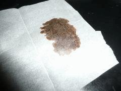 ICE O CS#15