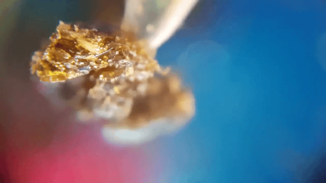 ? Extractions ?️