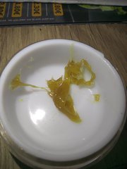 Extractions en tout genre