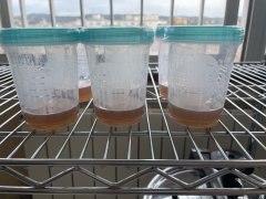 Tissue Culture v1