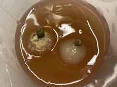 In vitro contamination